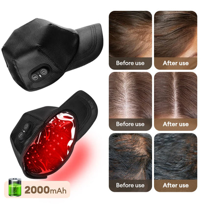 Hair Growth LED Cap