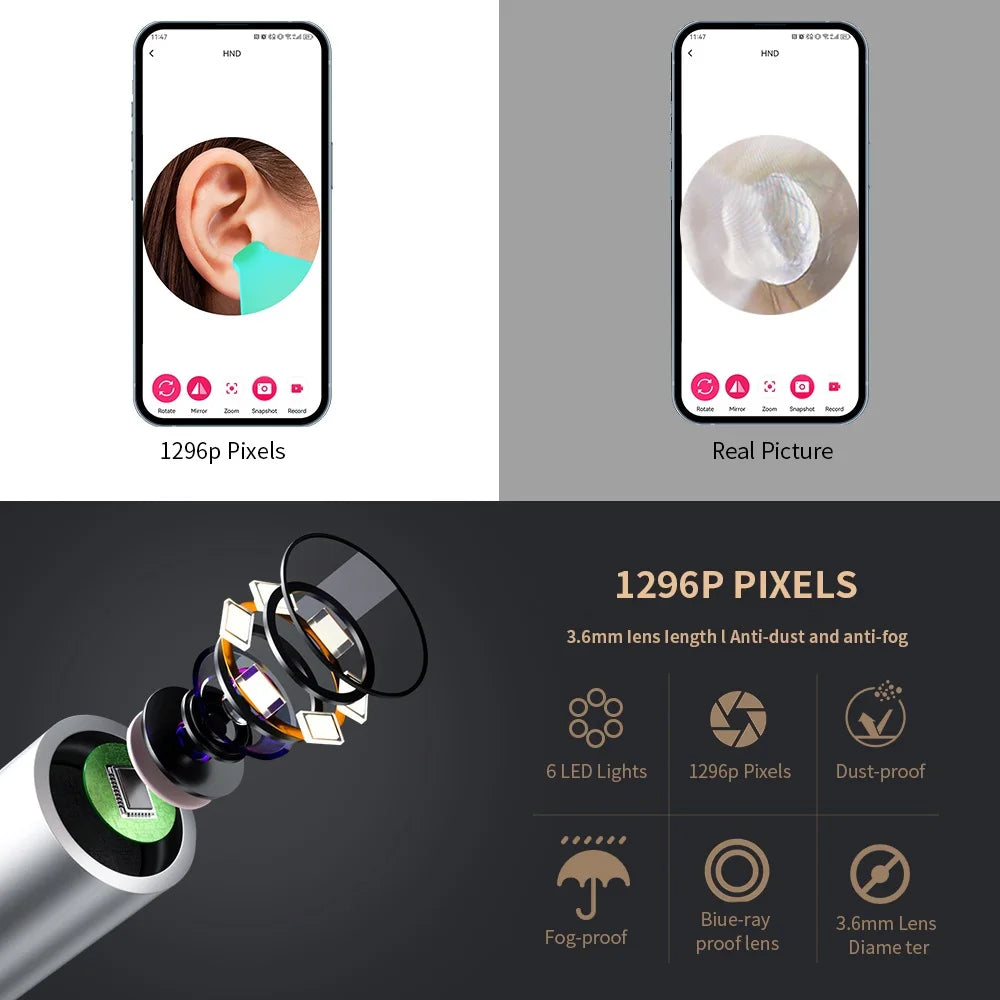 Smartlyo Smart Visual Ear Cleaner with Camera showing the device and its camera tip for ear cleaning and inspection.