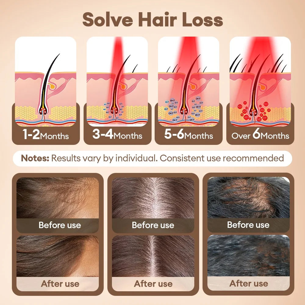 Hair Growth LED Cap