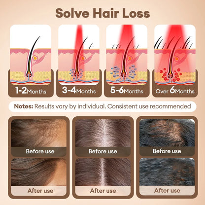 Hair Growth LED Cap