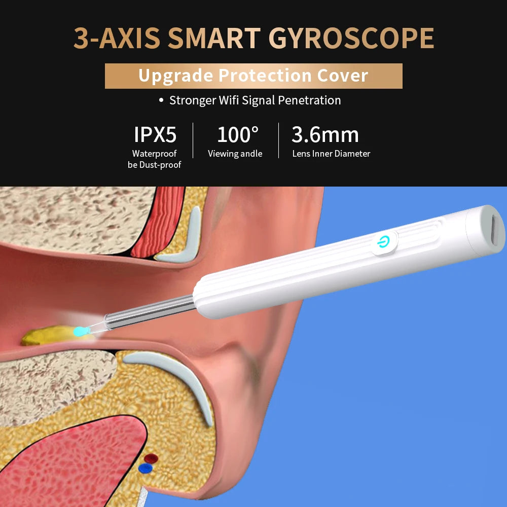 Smartlyo Smart Visual Ear Cleaner with Camera showing a close-up of the device with a built-in camera for ear cleaning inspection.